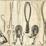 Аборт в истории